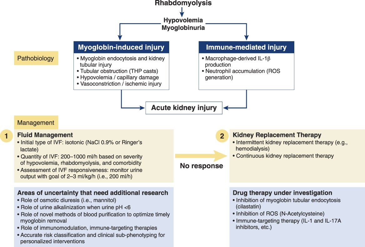 Rhabdomyolysis is a condition characterized by the destruction of skeletal muscle fibers and the release of intracellular contents into the bloodstream. This Kidney Case Conference: How I Treat article discusses treatment of rhabdomyolysis-induced AKI bit.ly/CJASN0372