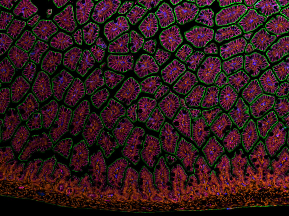 Happy #MicroscopyMonday! I love how my intestinal sections are typically a mosaic of floating villi #sciart #gitwitter #bioart #microscopy @NikonInst