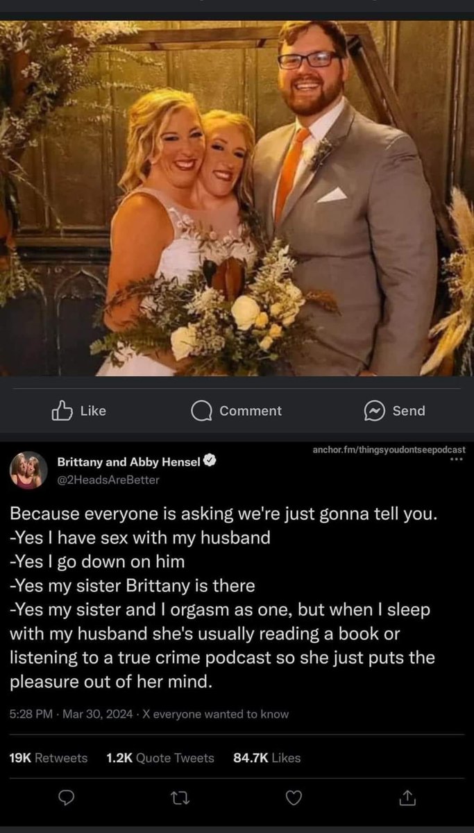 RMC52963's tweet image. #believe #twoheads #twins #marry