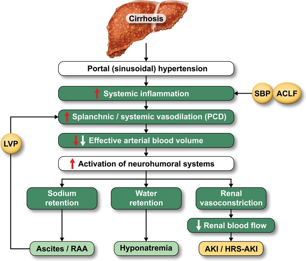 REVIEW
Controversies regarding albumin therapy in cirrhosis
#JonelTrebicka @ggarciatsao 
#LiverTwitter 
tinyurl.com/2j2burcu