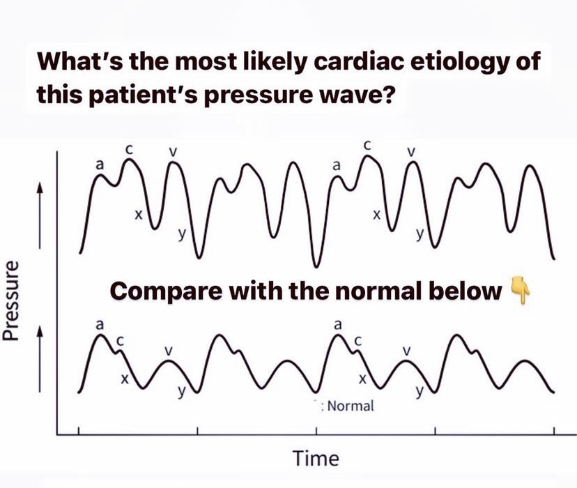 An overview of this hemodynamics quiz and answer explanation 👇

Nice example to intertwine physiology and pathology #moretocome 📚