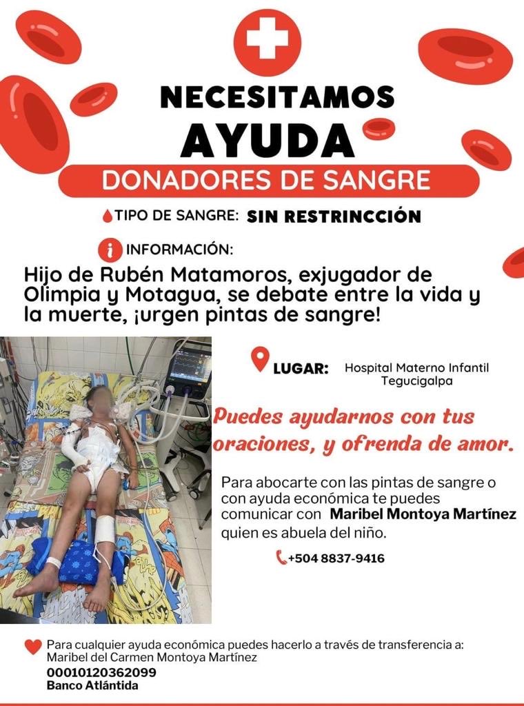 rtilguanth0408's tweet photo. Vamos que podes ayudar , un lempira cuenta https://t.co/EECYUt2PfV