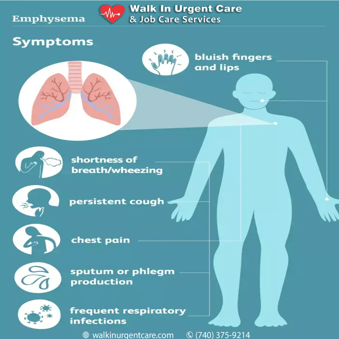 Seek medical attention if you've experienced prolonged shortness of breath, especially if worsening or impacting daily activities. Don't dismiss it due to age or fitness. Seek immediate help
#emphysema #COPDwarrior #walkinurgentcare #OhioState #UConn #Cleveland #WWERaw #Paige