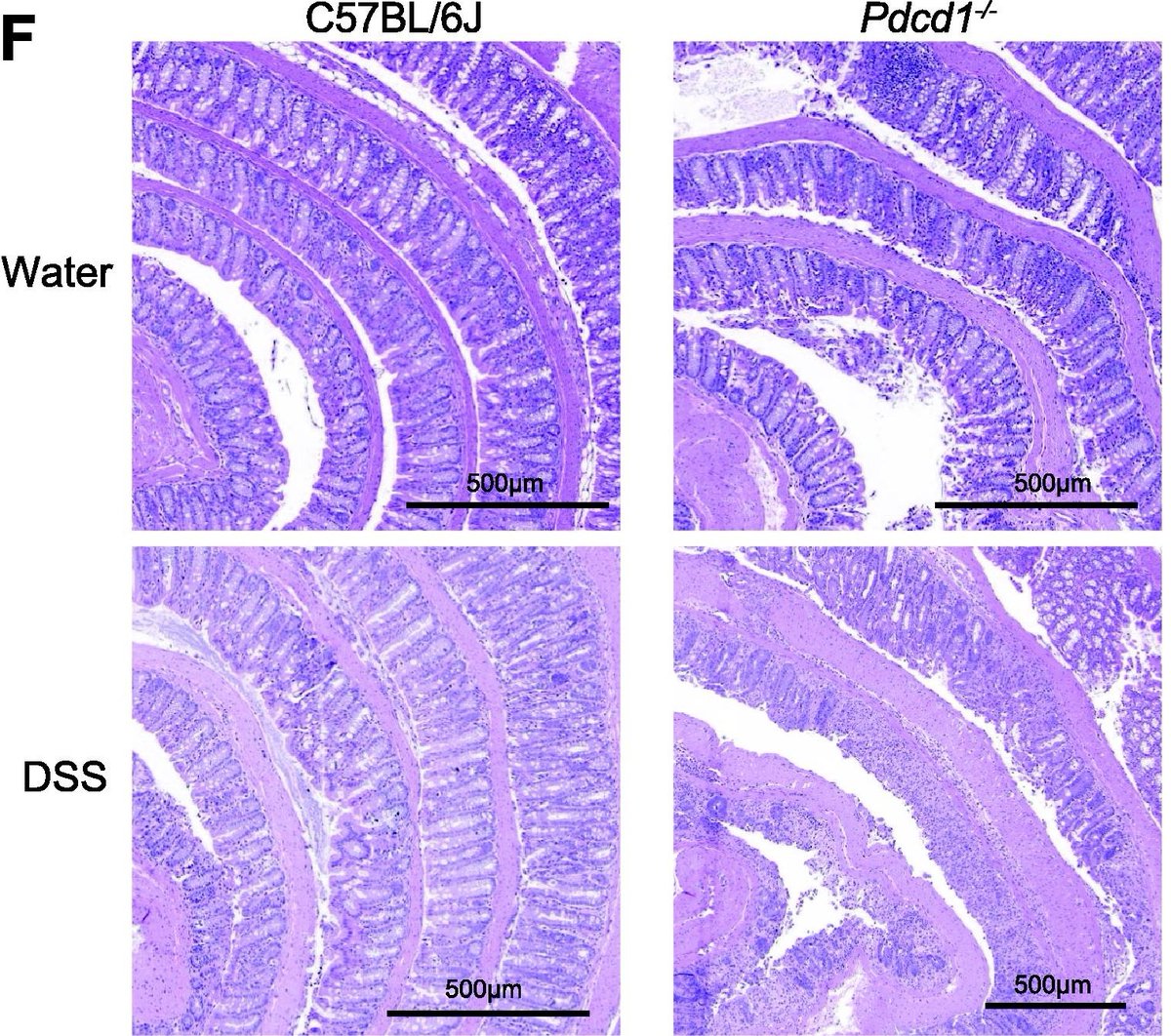 PD-1 regulates ILC3-driven intestinal immunity and homeostasis: mucosalimmunology.org/article/S1933-…