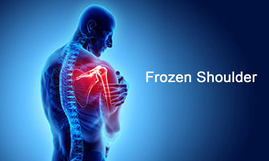 KingsParkChiro1's tweet photo. What Is Frozen Shoulder? Chiropractor Near Me -
Frozen shoulder is (also known as adhesive capsulitis) is a common condition that develop in 40s or - https://t.co/zaskaAD7xL - #Chiropractic #ChiropractorNearMe https://t.co/8XlyrmDMIg