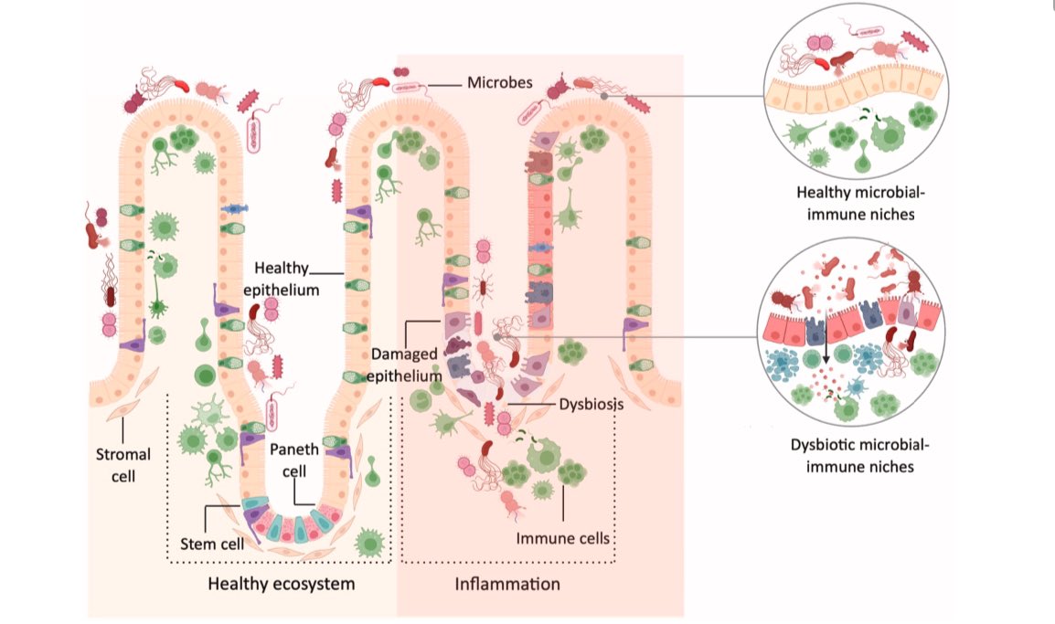 Soumi_Chatter's tweet image. Beyond excited to announce that our review article on understanding why studying #microbes and the #eukaryotic host #immune components while preserving their #spatial context is essential. #SCDB
authors.elsevier.com/c/1is5a3si8Pym… Thanks to my mentor @armish1910 and @asharmaiisc