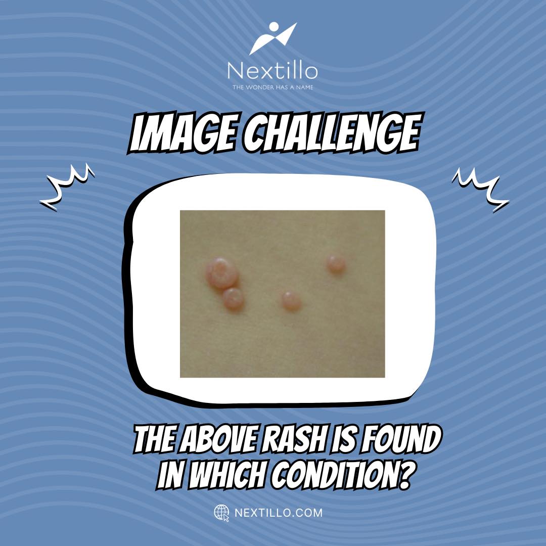 Here’s today’s #ImageChallenge! Can you identify the condition in this image? 📷

#medicalmemes #fmge #fmge_mci_exam #medicalinformation #fmgequestions #fmgepreparation #medicalstudent #radiology #radiologysigns #radiologyquiz #mriscan #mriquestions #ctscan #pathology