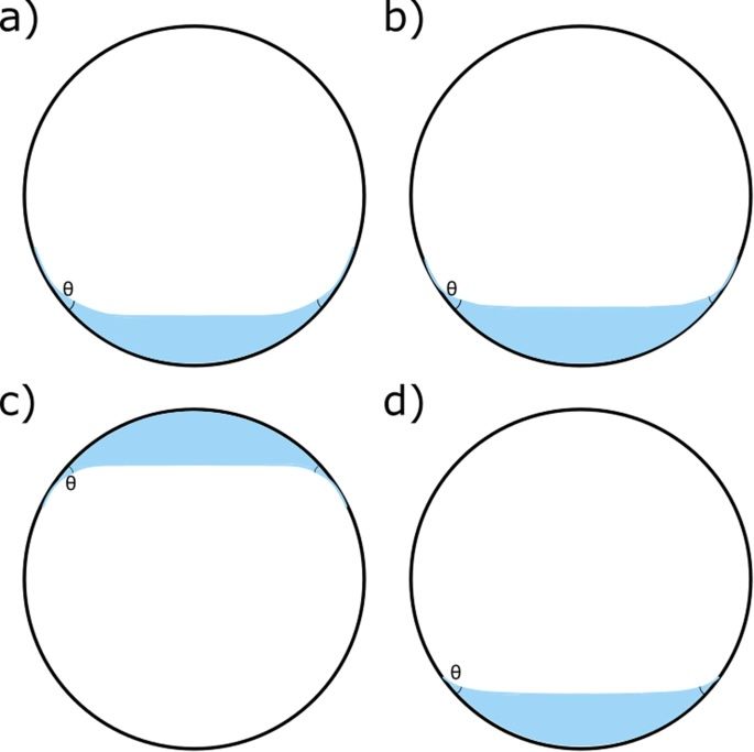 Review of recent work on silicone oil emulsification presented at the 2023 Cambridge Ophthalmological Symposium on Engineering and the Eye asks the engineer's question: Why is emulsification not more common? Read #OpenAccess here: nature.com/articles/s4143… #Ophthalmology #FOAMed