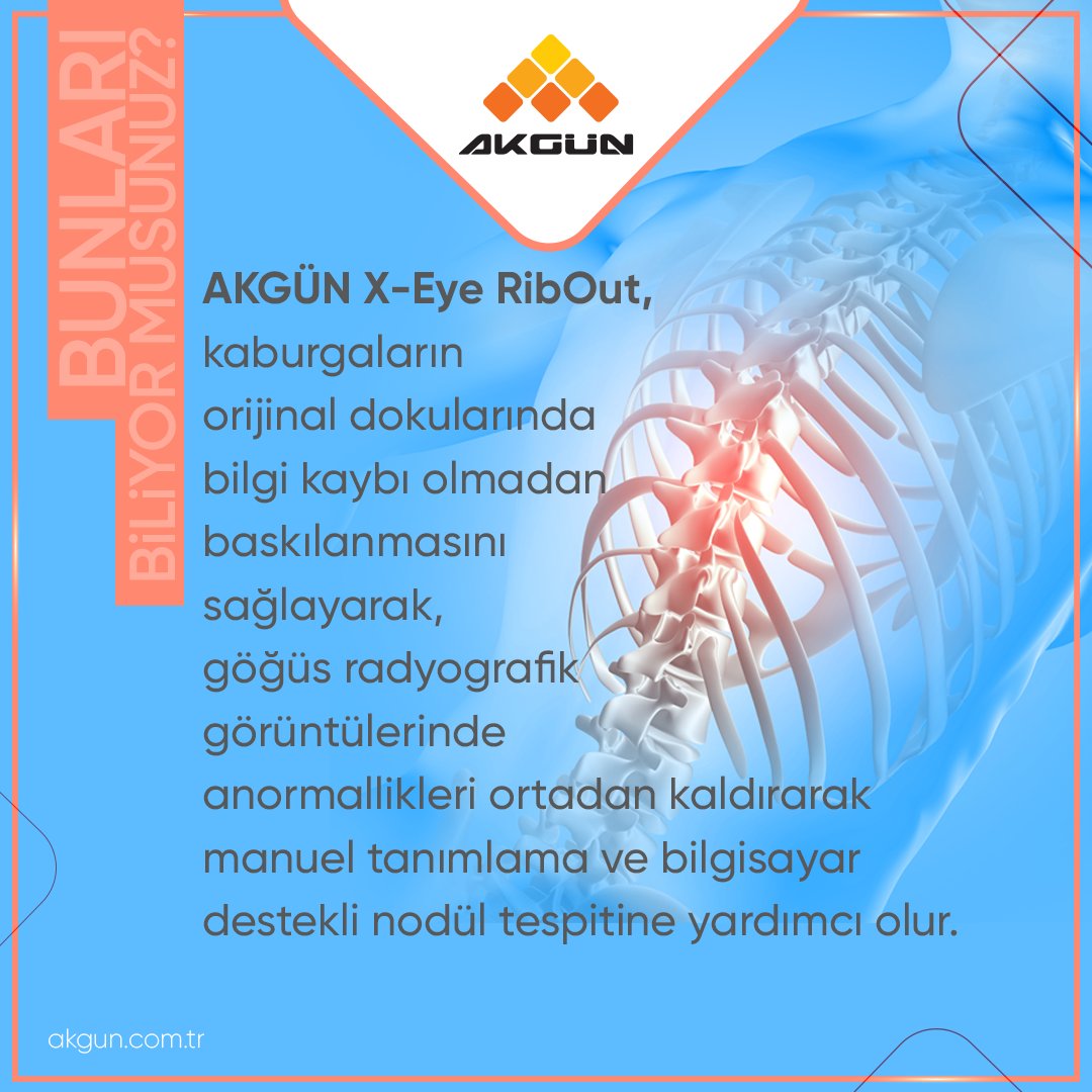 AKGÜN X-Eye RibOut'un, kaburgaların orijinal dokularında bilgi kaybı olmadan göğüs radyografik görüntülerindeki anormallikleri ortadan kaldırdığını biliyor muydunuz ? #AKGÜNTeknoloji #YaşamınHerAlanında #Dijitalleşme #DijitalDönüşüm #DijitalÇözümler