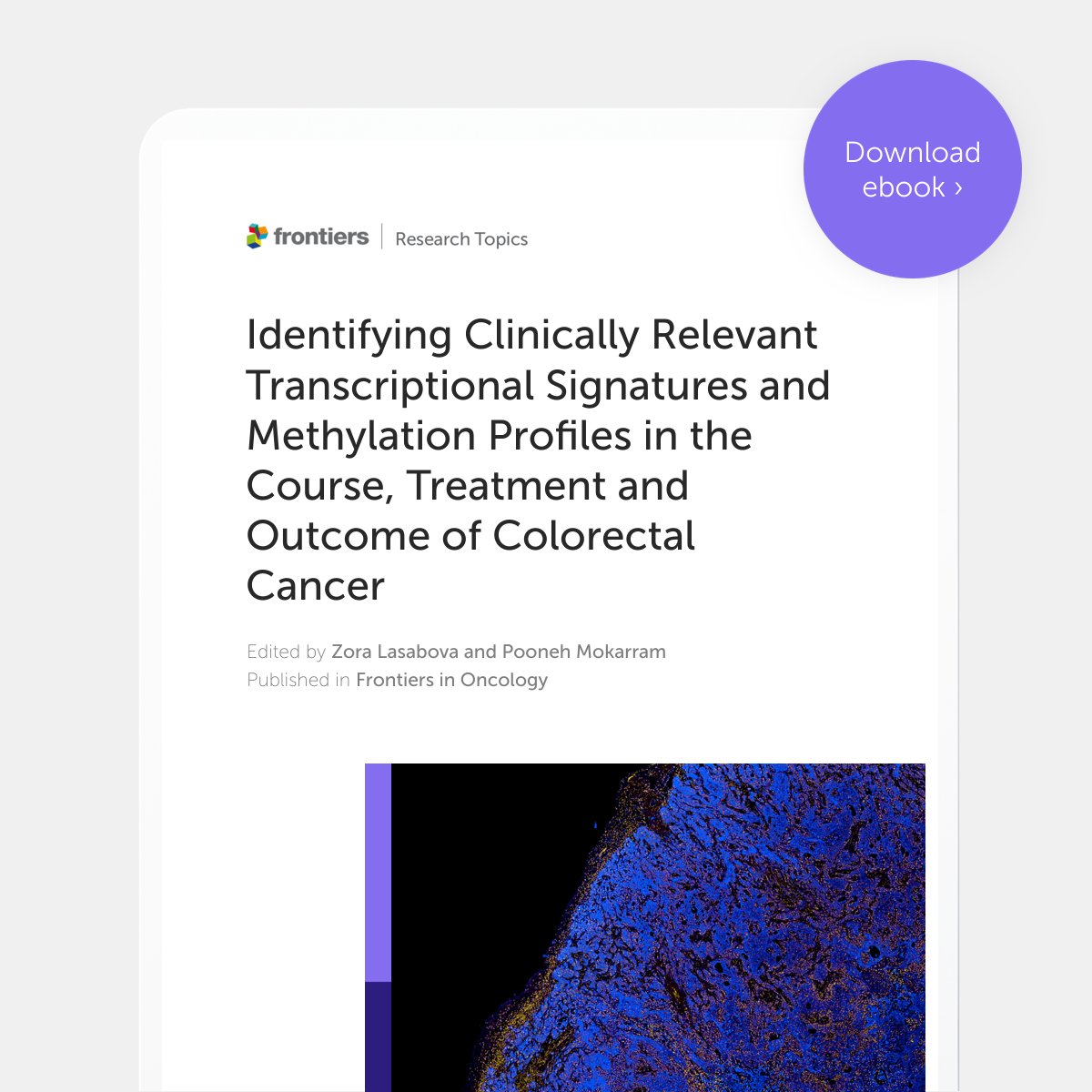 📢 Our new eBook 'Identifying Clinically Relevant Transcriptional Signatures and Methylation Profiles in the Course, Treatment and Outcome of Colorectal Cancer' is now available to download for free! Download your free copy here 👉fro.ntiers.in/RT43725