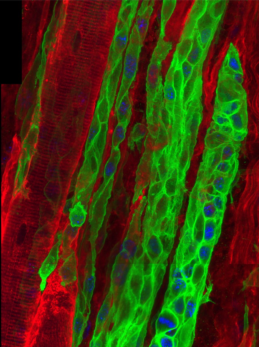 At long last published! Skeletal muscle regeneration in 3 dimensions! Thanks to @bc_collins3 Jake Shapiro @MyaScheib @robvmusci @Mayank_Verma_ #myotwitter @Dev_Cell cell.com/developmental-…