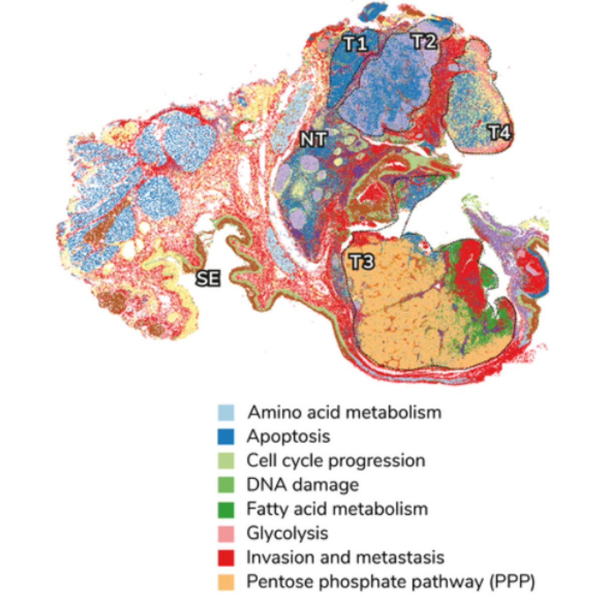 AkoyaBio's tweet photo. Today, we're featuring a figure that shows whole-slide #singlecell #spatialphenotyping of a human FFPE #headandneck squamous cell carcinoma with an ultrahigh-plex antibody panel using our #spatialbiology solution.

It reveals four distinct tumor regions with varying metabolic and stress profiles.

Join us at #AACR24 to learn how advanced spatial phenotyping can help predict tumor sensitivity and insights into immunotherapy. https://t.co/iyysGDrTag