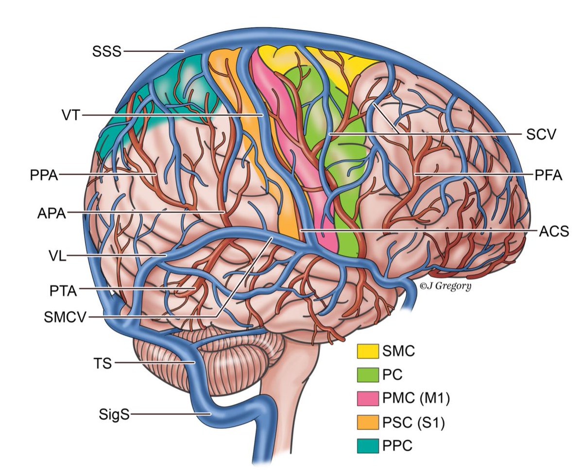 The age of brain–computer interfaces (BCIs) is coming. But where do we put these devices? @tomoxl New article alert! Superior cortical venous anatomy for endovascular device implantation: a systematic review bit.ly/4ahlvo1