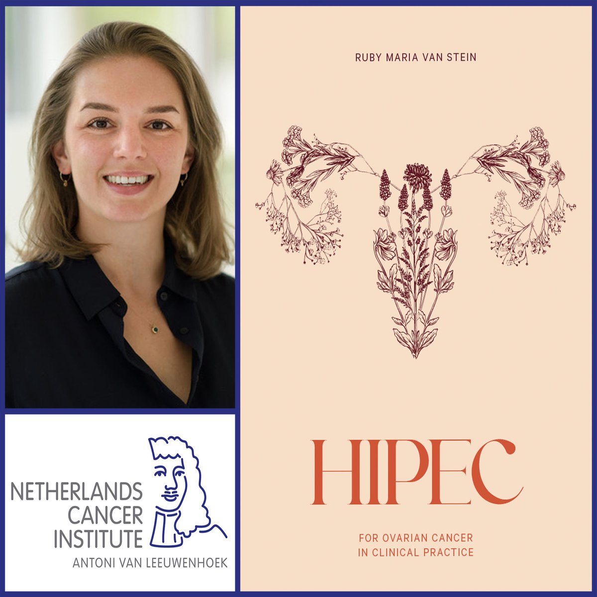 Thanks to the efforts of PhD candidate Ruby van Stein @hetAVL @UvA_Amsterdam, the HIPEC treatment and comprehensive information about it are now available to all ovarian cancer patients. ➡️ bit.ly/3VP9PnQ