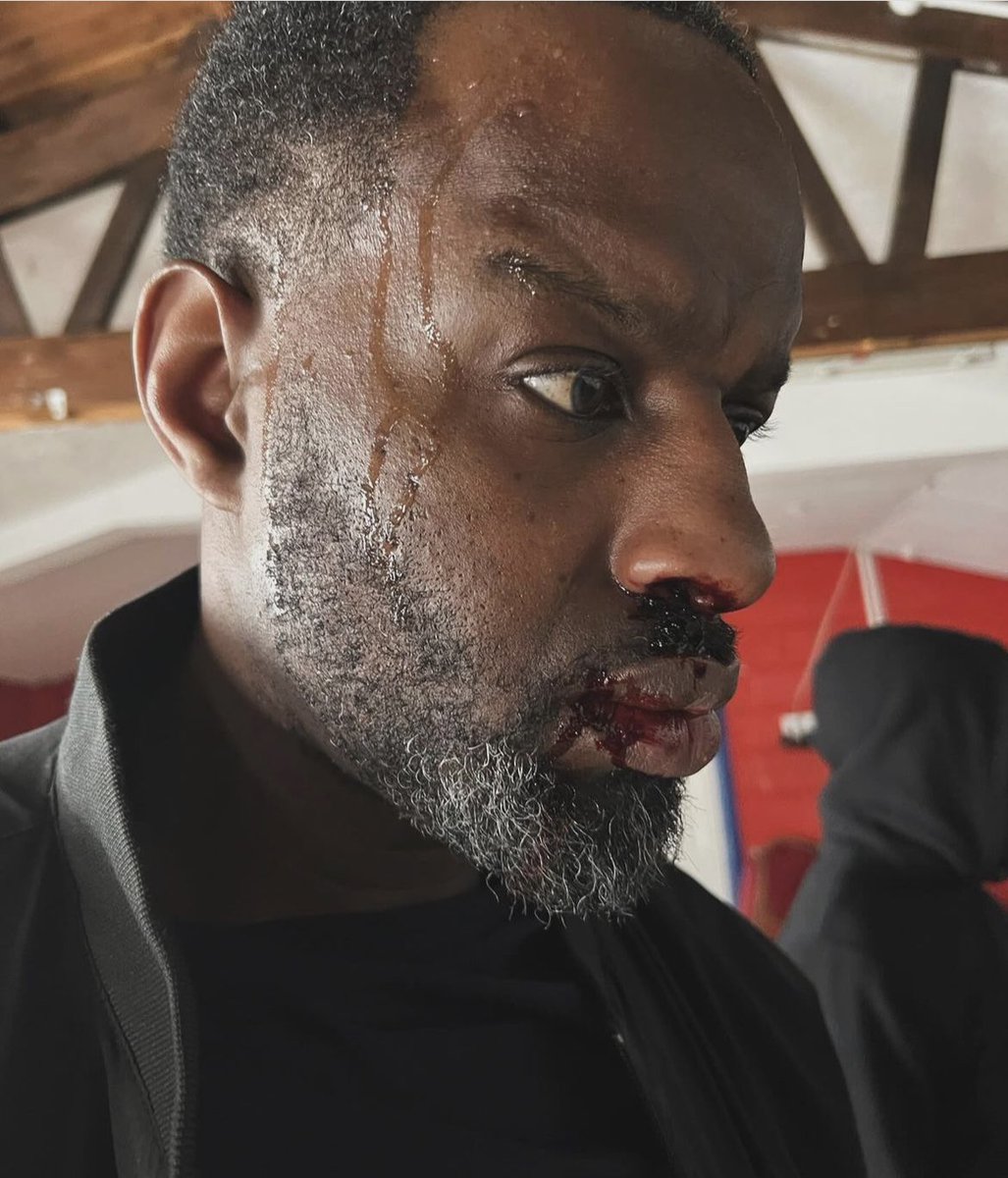 Eleazar_Talent's tweet photo. Darren Oderinde as Donte! SFX make-up by @mua_triptisingh #actors #CASTING #actorslife #work #deonfeaturefilm https://t.co/p70WUaYMTN