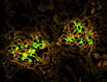 Christie Wilcox (@nerdychristie) on Twitter photo When usually helpful bacterial partners go rogue, they can turn our body's defenses against us. That story, an update on the avian flu infecting cows, and more of the best from <a href="/ScienceMagazine/">Science Magazine</a> and science in today's #ScienceAdviser: science.org/content/articl… When usually helpful bacterial partners go rogue, they can turn our body's defenses against us. That story, an update on the avian flu infecting cows, and more of the best from <a href="/ScienceMagazine/">Science Magazine</a> and science in today's #ScienceAdviser: science.org/content/articl…