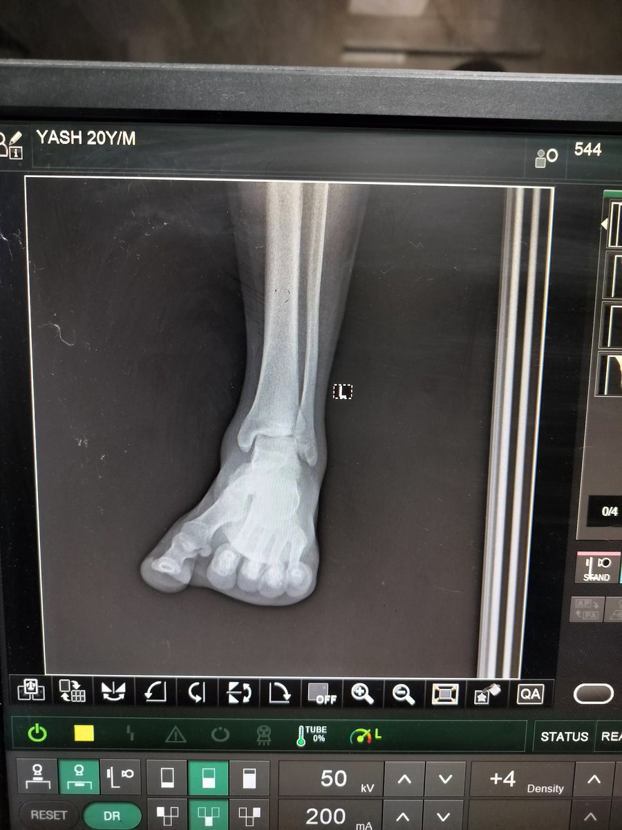 takash01's tweet photo. GTB hospital Delhi, Near Dilshad garden in the heights of corruption giving X-Rays to patients on their phones. The welfare state concept was shaken to its roots. So, अस्पताल अच्छे हो गए है केजरीवाल जी। @ArvindKejriwal @BJP4India @AdvRajendraPal @MoHFW_INDIA https://t.co/0BLSbLHvBu