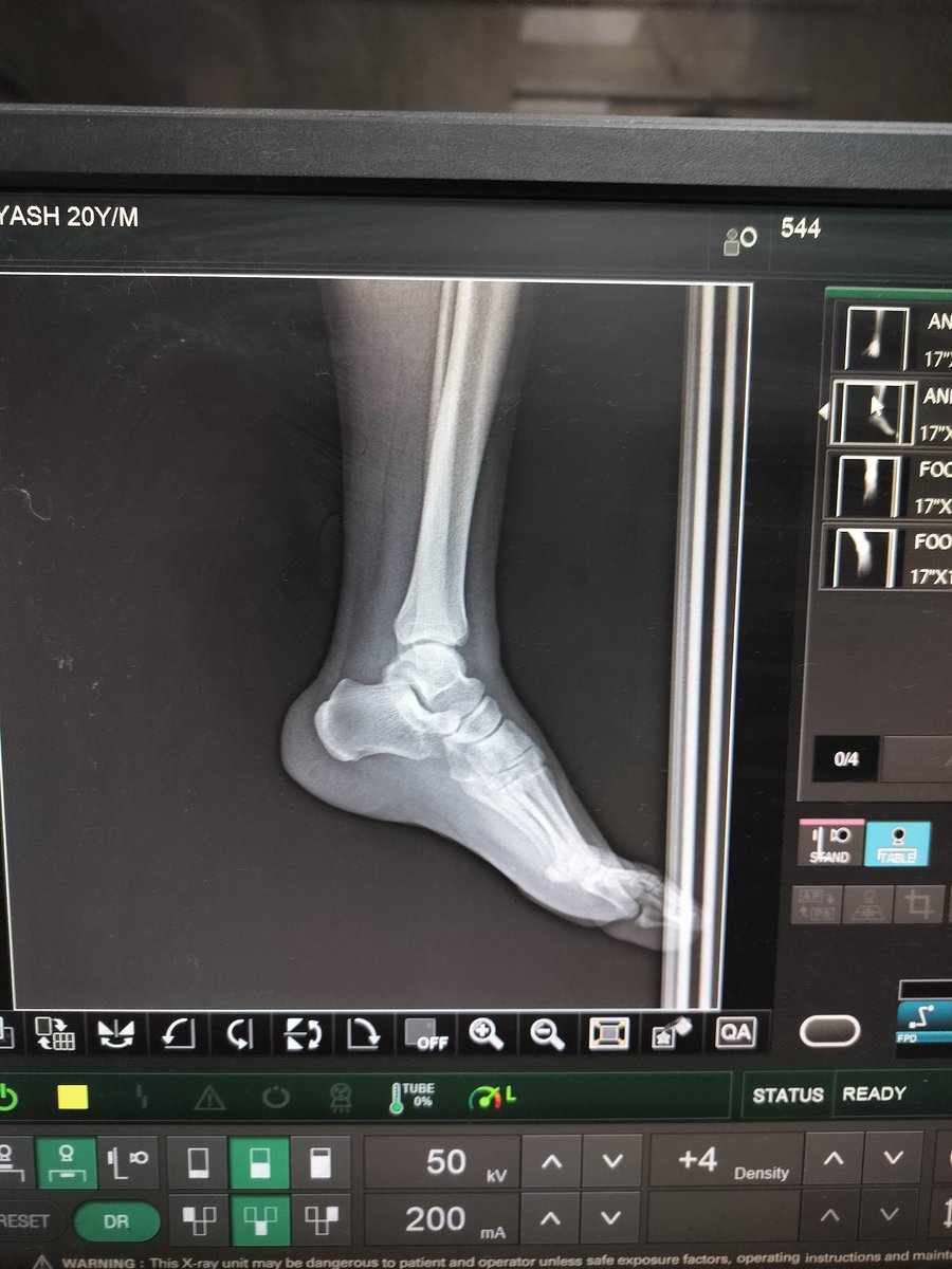 takash01's tweet photo. GTB hospital Delhi, Near Dilshad garden in the heights of corruption giving X-Rays to patients on their phones. The welfare state concept was shaken to its roots. So, अस्पताल अच्छे हो गए है केजरीवाल जी। @ArvindKejriwal @BJP4India @AdvRajendraPal @MoHFW_INDIA https://t.co/0BLSbLHvBu