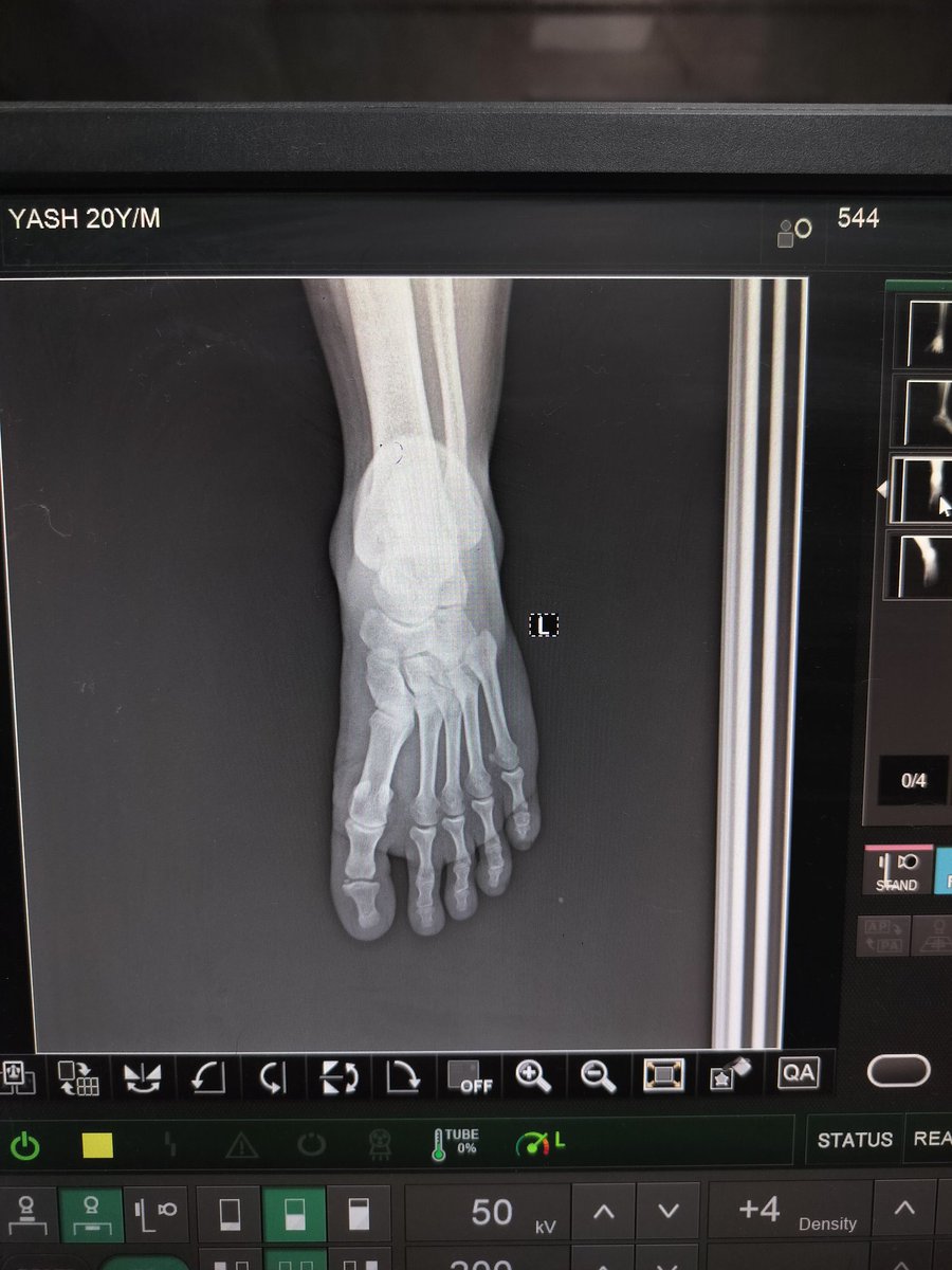 takash01's tweet photo. GTB hospital Delhi, Near Dilshad garden in the heights of corruption giving X-Rays to patients on their phones. The welfare state concept was shaken to its roots. So, अस्पताल अच्छे हो गए है केजरीवाल जी। @ArvindKejriwal @BJP4India @AdvRajendraPal @MoHFW_INDIA https://t.co/0BLSbLHvBu