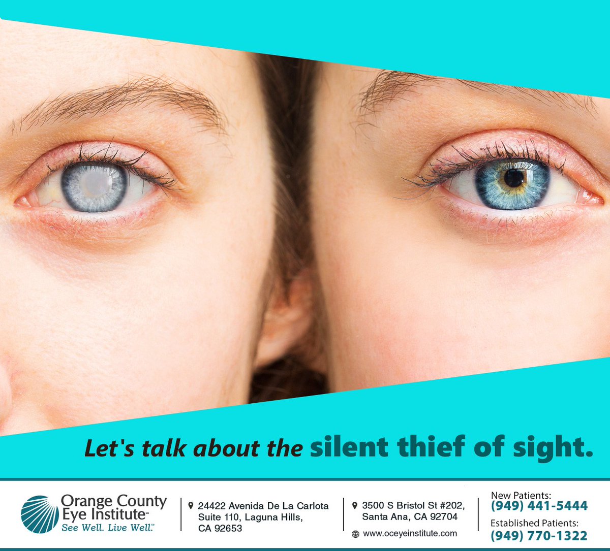 OCEyeInstitute's tweet image. Glaucoma, the silent thief of sight, is the leading cause of blindness worldwide. Over half of people afflicted are unaware they have this disease due to a lack of symptoms. Learn more at oceyeinstitute.com #glaucoma #lagunahillseyedr