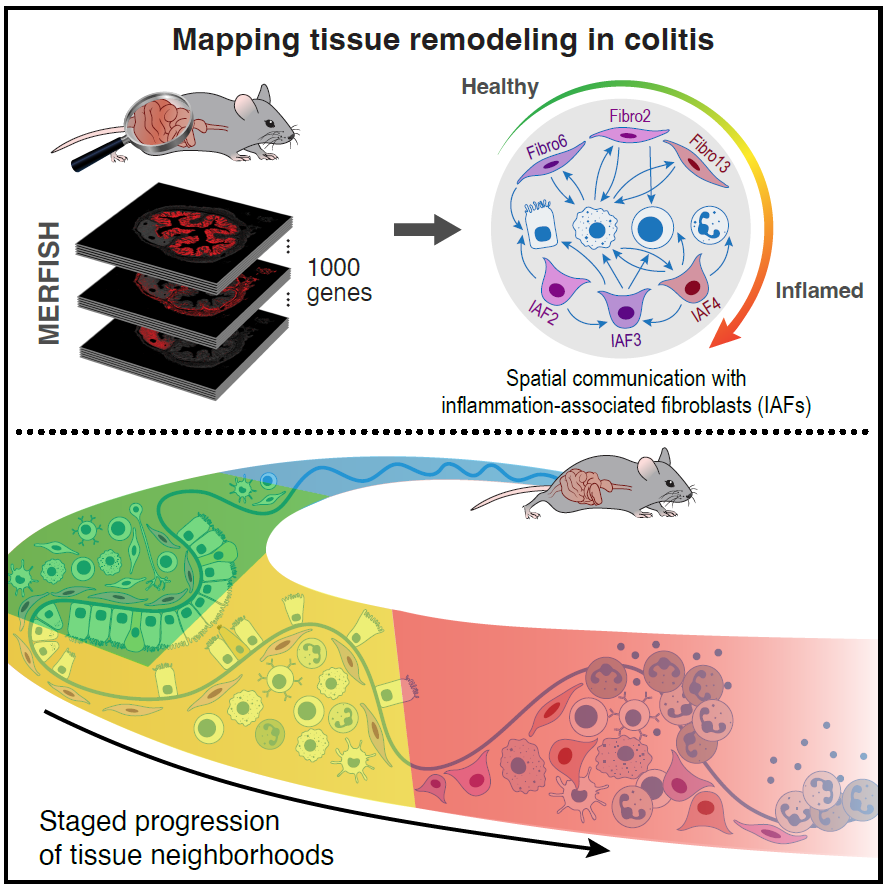 Roni Nowarski (@nowarskilab) on Twitter photo Thrilled to have our work mapping tissue remodeling in intestinal inflammation online! An amazing collaboration between <a href="/SivanathanKisha/">Kisha Sivanathan</a> and Paolo and Jeff in the <a href="/MoffittLab/">Moffitt Laboratory</a> probing the diversity and origin of #inflammation associated #fibroblasts. doi.org/10.1016/j.cell… Thrilled to have our work mapping tissue remodeling in intestinal inflammation online! An amazing collaboration between <a href="/SivanathanKisha/">Kisha Sivanathan</a> and Paolo and Jeff in the <a href="/MoffittLab/">Moffitt Laboratory</a> probing the diversity and origin of #inflammation associated #fibroblasts. doi.org/10.1016/j.cell…