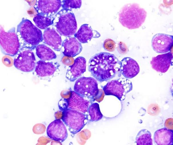 modernHealthMe's tweet photo. Diagnosis? https://t.co/kM6KXUKClN