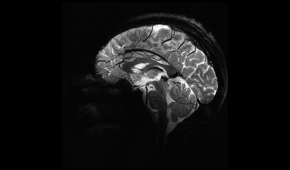 _rutvik_patel's tweet photo. After almost 20 years of R&amp;D, The CEA's Iseult project have released MRI Brain images of 11.7 Tesla MRI machine.
What a beauty!🔥
#MedX
#RadRes https://t.co/eyKaTmFIb4