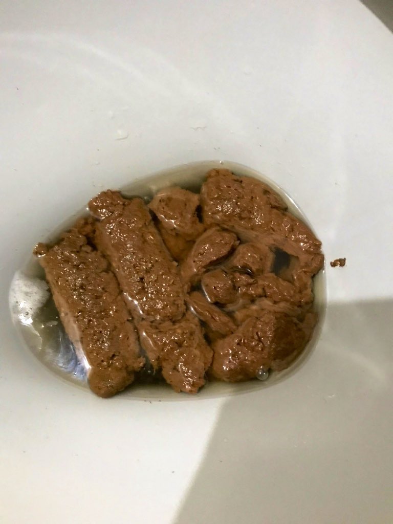 Scateirohard's tweet image. Today there was a lot of shit for you!

Hoje teve muita merda para vocês!
.
.
.

#gayscat #scatgay #gayshit #shiteater #scat #scateiro #humantoilet #sexscat #gayfetish #pig #pigboy