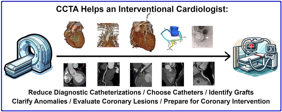 📢💡#Cardiac #CTA is increasingly utilized to assess pts' coronary anatomy. For many pts, it offers a noninvasive way to evaluate the need for heart catheterization & can enhance ICs info in the cath lab. ➡️doi.org/10.1016/j.jsca… #JSCAI #CardiacCTA Special Issue📚