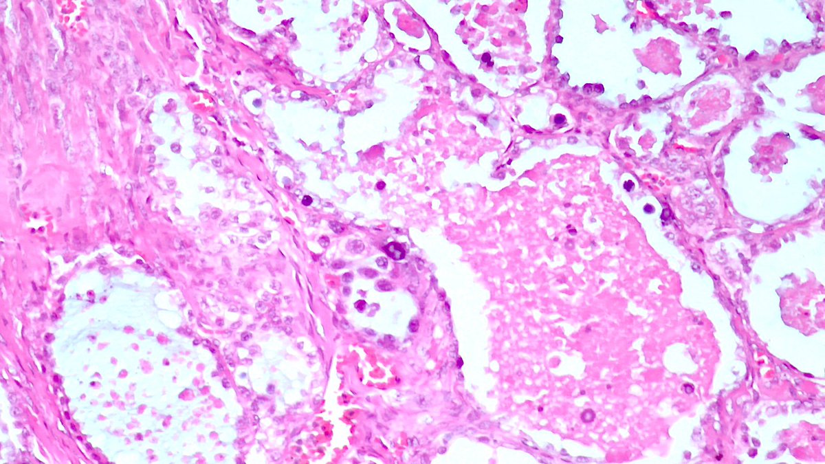 Estef Valdés tweet media