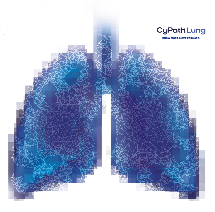 New study suggests that dropping pack-years for #lungcancer screening eligibility in favor of a simpler 20-year smoking history could increase the number of cancers detected & reduce racial disparities. See the study at bit.ly/3VGpBS4 #cypathlung #lungcancerscreening