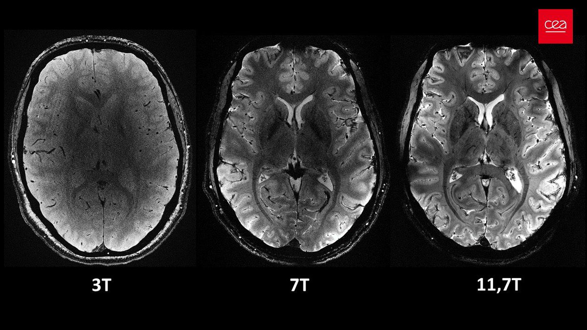 @EmmanuelMacron 💡The Iseult project: world’s most powerful MRI machine with a magnetic field intensity of 11.7 teslas. The best and most commonly used MRIs use 1.5 to 3 teslas 🧠 🤩 👏 Bravo CEA - @SiemensHealth - @GuerbetGroup - @UniFreiburg - @EmmanuelMacron👇🏻: 4 minutes, 3T, 7T & 11,7 Teslas