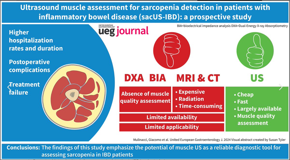 drRobinDud's tweet photo. Sarcopenia 👉one of malnutrition indicator
and 🫴ultrasound muscle assessment in #IBD👌
#US measurements of
- biceps brachii 💪
- rectus 🫄abdominis
- rectus femoris🦵
🫴reliable & easy alternative to #MRI & #BioelectricalImpedanceAnalysis
https://t.co/XlKffL4mUl
@UEGJournal