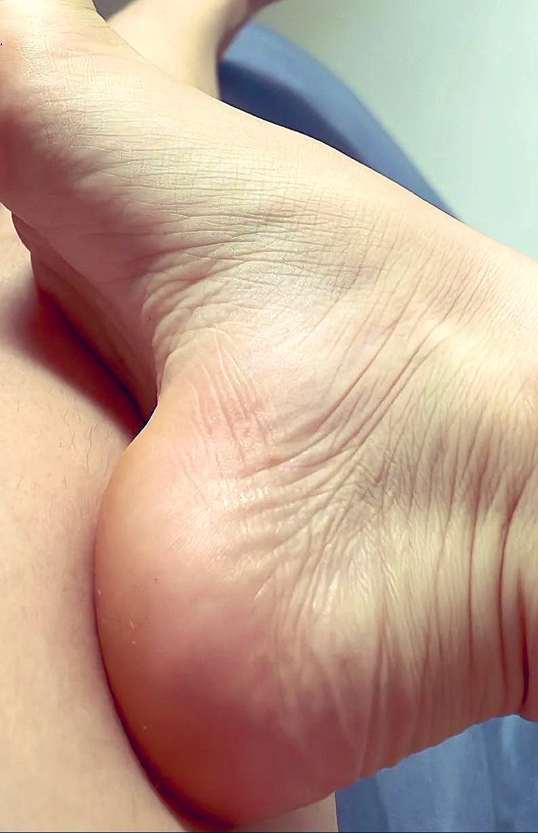 CapaDayana's tweet photo. Bonne nuit 🌙 hermosos, deliciosos, jugosos del 🍆 besos 😘😈😈 #pies #PiesFetiches #feet #sexyfeet #feetworshi̇p #FOOTFETİSH #toes #feetnation @Tweety_Feet @FeetFinder @FeetRetweets #BuenosDiasMundo #soles #footworshi̇p #feetlover #delicioso #feethot #feetbeautiful https://t.co/m8eUxYcEK1