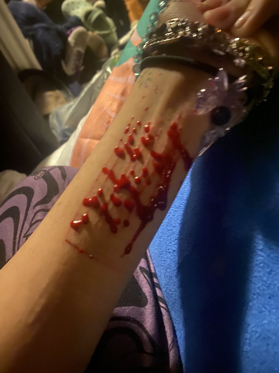 Tw-sh 
I thought these looked so pretty😜 but the blood was like goopy it grossed me out