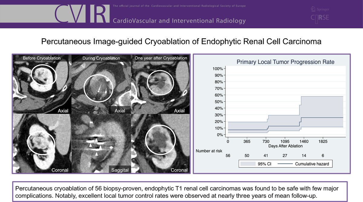 Read now in CVIR 📖 Percutaneous Image-Guided #Cryoablation of Endophytic Renal Cell Carcinoma bit.ly/3VDIIMJ #OpenAccess 🔓 @olegraumann