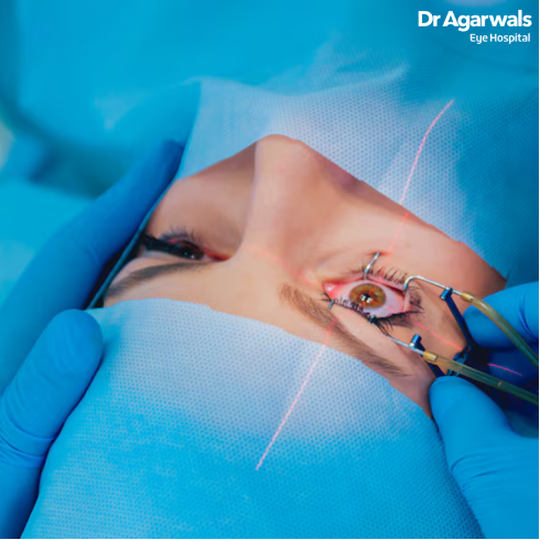 AmarjeetKa96474's tweet image. What are the Myths About LASIK Surgery?

metroxp.com/what-are-the-m…

#LASIKMyths #LASIKMisconceptions #LASIKFacts #ClearingTheLASIKMisconceptions