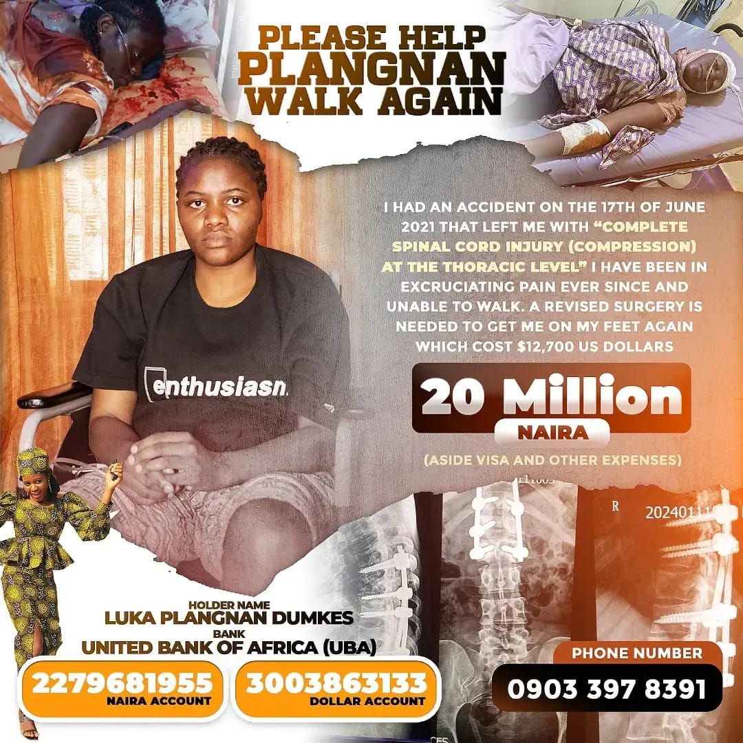 EmpressQuinnie's tweet photo. Please help @Starr_7731 walk Again

1 USD Abuja Dangote
#1USD #Abuja #Dangote #FIRS #Trending https://t.co/vvz9FPdSa9