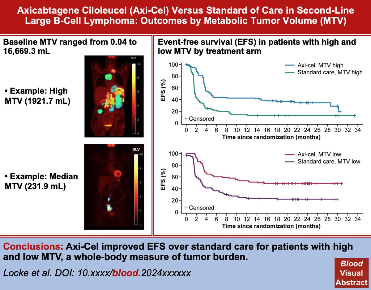 Locke et al (@Kersten_MJ) PET sub-analysis of ZUMA-7 out in @BloodJournal #lymSM Axicabtagene ciloleucel versus standard of care in second-line large B-cell lymphoma: outcomes by metabolic tumor volume ashpublications.org/blood/article/…