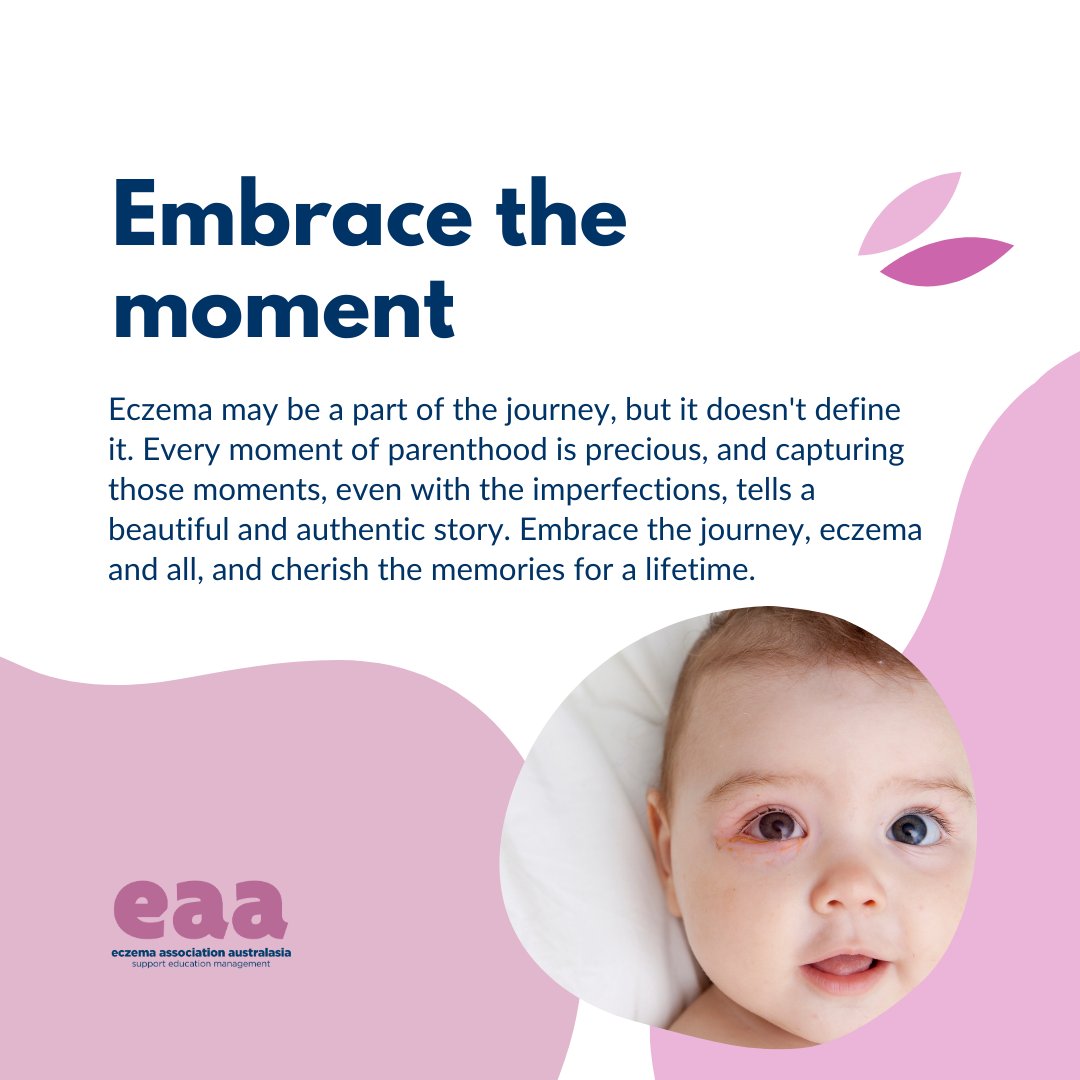 EczemaAu's tweet photo. Don’t let childhood eczema overshadow the beauty of your baby’s early days. We have put together a few tips to help you focus on capturing the love and connection between you and your baby. Investing in professional photography is about preserving memories that last a lifetime. https://t.co/iOm3iq1CZQ