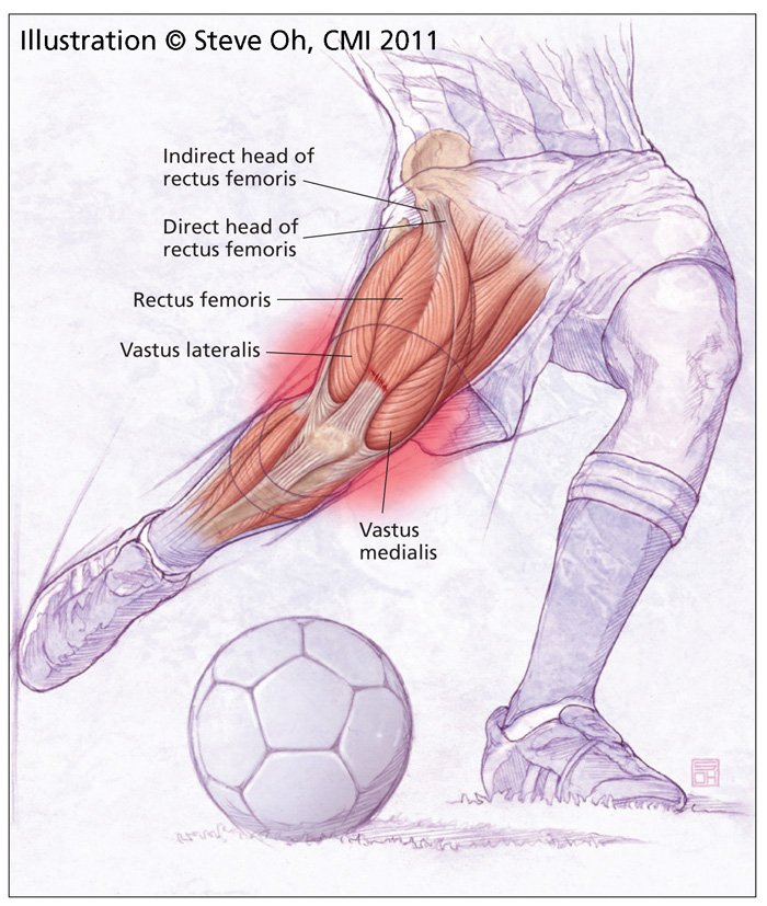 physiotutorspot's tweet photo. The answer is Rectus Femoris https://t.co/zYuNugfciM