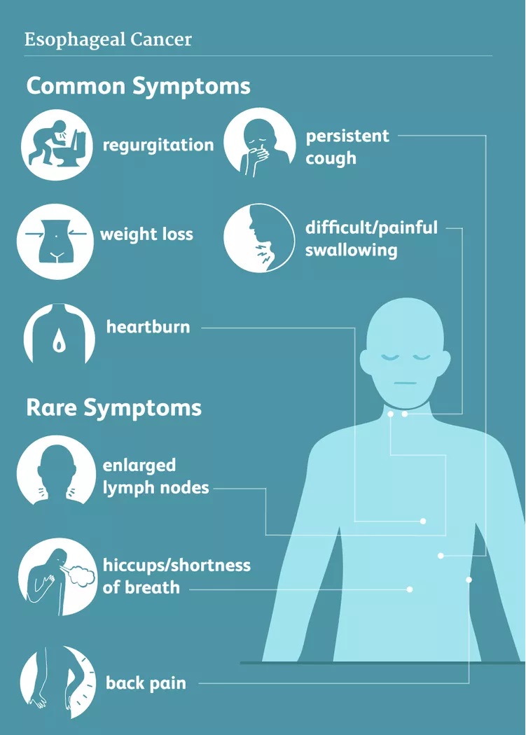 Spotting esophageal cancer: watch for signs such as difficulty swallowing, persistent indigestion, change in voice /hoarseness, chest pain, chronic indigestion, or heartburn and unintentional weight loss, #EsophagealCancerAwareness #KnowTheSigns