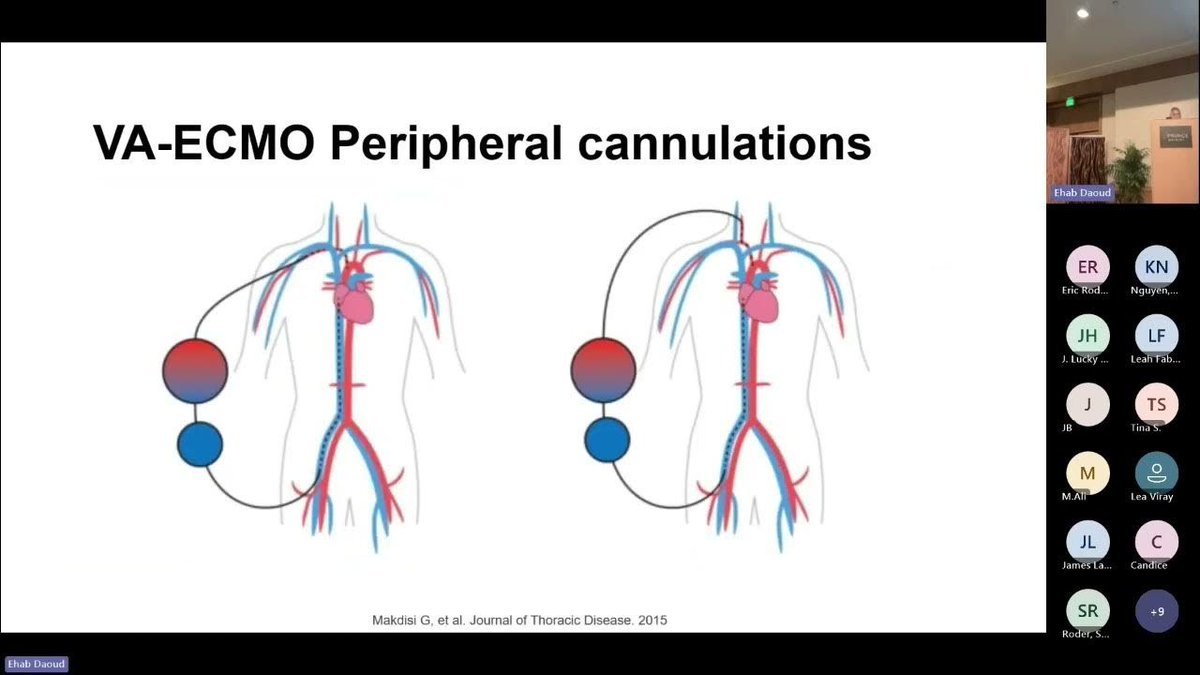 ECMO: Dr. Giselle Baquero. Society of Mechanical Ventilation Conference 2023 youtu.be/wpOrNhV9Rvk