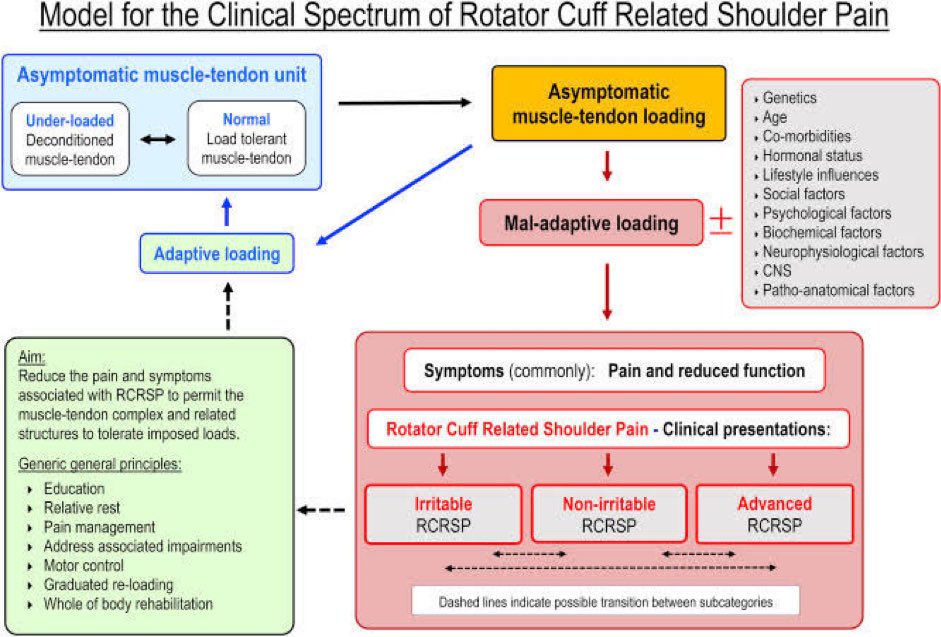 Omid_HopeUni's tweet photo. Clinical spectrum of Rotator Cuff Related Shoulder Pain (RCRSP)👇🏼

RCRSP👉🏼a spectrum of shoulder conditions👇🏼
▶️subacromial pain (impingement) syndrome
▶️rotator cuff tendinopathy
▶️symptomatic partial
▶️full thickness rotator cuff tears

#shoulder #pain 
https://t.co/UffbbQFVPy https://t.co/4u5ZDmVAYJ