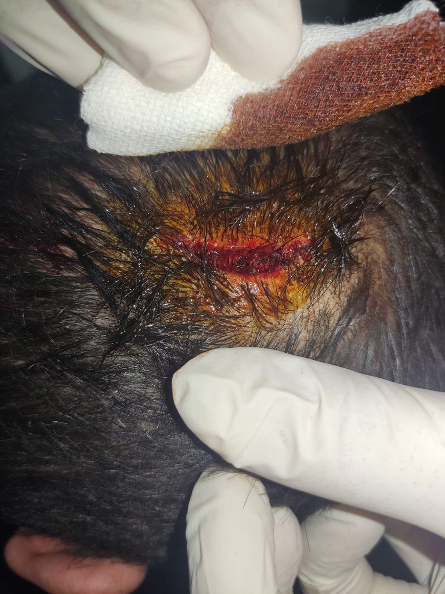 Tekirdağ Çorlu Devlet Hastanesi Destek ve Kalite Hizmetleri Müdür Yardımcısı Cumali Kocaş, Ortez Protez Teknikeri Hep-Sen İlçe Temsilcimize saldırmış ve darp etmiştir.
Torpilli yöneticilerin kamu makamlarının istilası sonucu aşağıdaki görseldedir.

Hep-Sen ve Polmed olarak