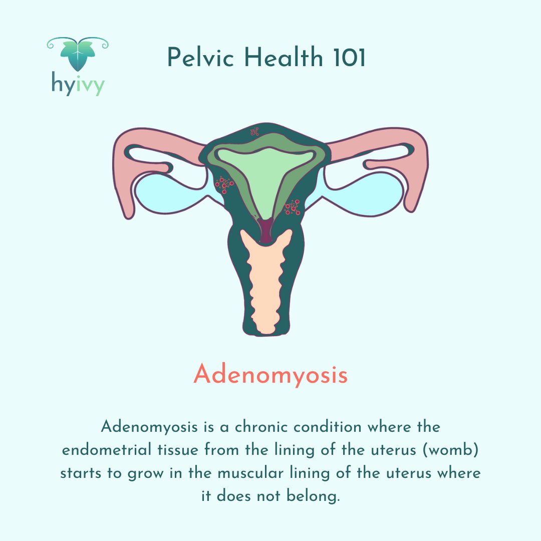This #AdenomyosisAwarenessMonth learn more about #pelvicpain and this condition at hubs.la/Q02rtC-t0 ____ #HyivyHealth #pelvicfloor #FemTech #endometriosis #adenomyosis #chronicpain #womenshealth #pelvichealth #pelvicfloorpt #painfulsex #pelvicfloordysfunction