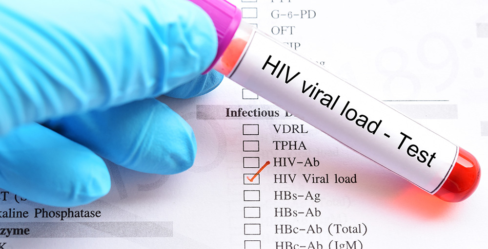 Long-acting, injectable anti-retroviral therapy may offer a path forward for people with HIV to achieve suppression. bit.ly/3J1I0Bp @CROI2024 via @AadiaMd