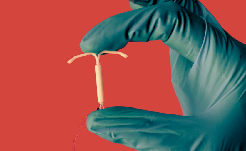 ‘Just a pinch’: Women frustrated as medical community downplays pain of IUD insertion healthydebate.ca/2024/04/topic/… @miranda_joli @HealthyDebate 

CanadaHealthwatch.ca — Canada's hub for health news 🍁