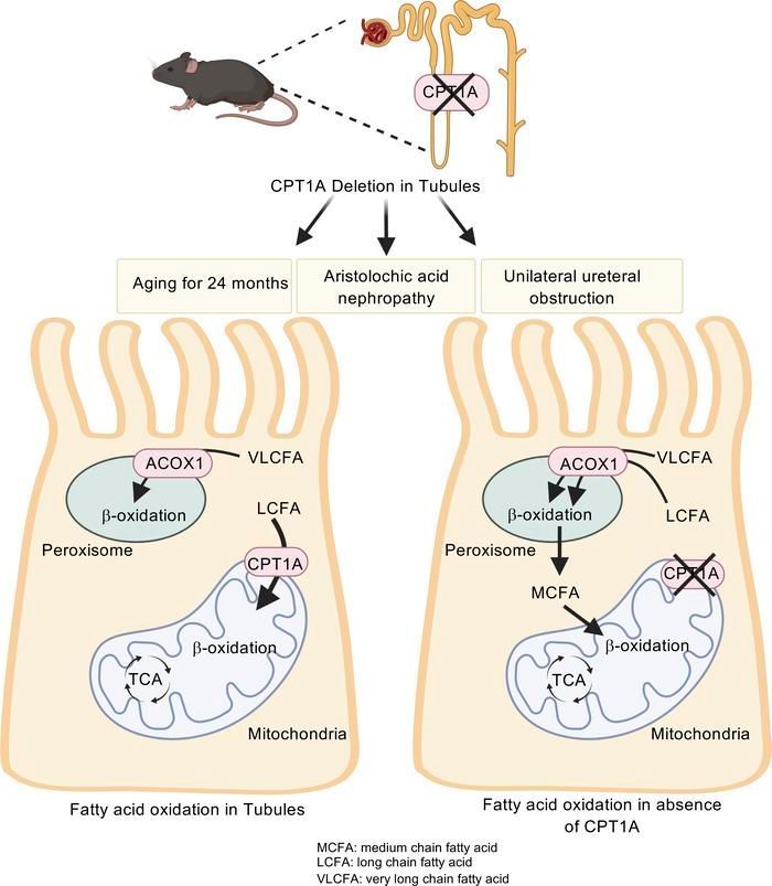 JCI insight (@jci_insight) on Twitter photo Tubular CPT1A deletion minimally affects aging and chronic kidney injury: buff.ly/43Kzwbt
<a href="/LeslieGewin/">Leslie Gewin</a> <a href="/WUSTLmed/">Test Account</a>
#Metabolism #Nephrology Tubular CPT1A deletion minimally affects aging and chronic kidney injury: buff.ly/43Kzwbt
<a href="/LeslieGewin/">Leslie Gewin</a> <a href="/WUSTLmed/">Test Account</a>
#Metabolism #Nephrology