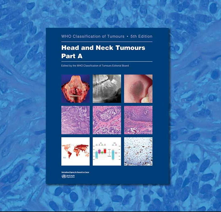 WHO Classification of Tumours: Head and Neck Tumours is now available in print format. Head and Neck Tumours is Volume 9 in the 5th edition of the @WHO series on the classification of human tumours, AKA the #WHOBlueBooks. iarc.who.int/news-events/pu…